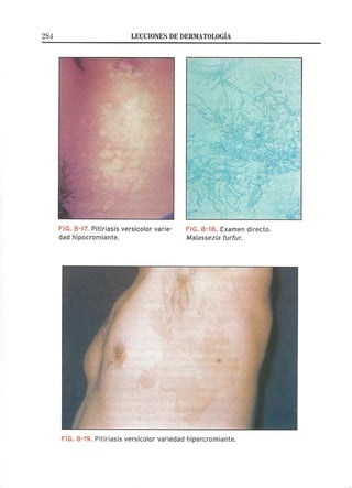 Lecciones de Dermatología