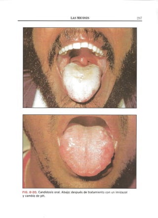 Lecciones de Dermatología