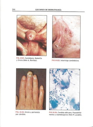 Lecciones de Dermatología