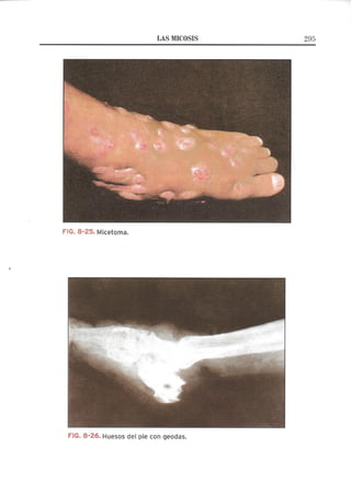 Lecciones de Dermatología