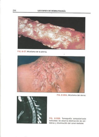 Lecciones de Dermatología