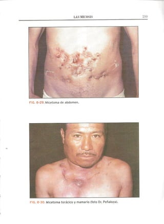 Lecciones de Dermatología