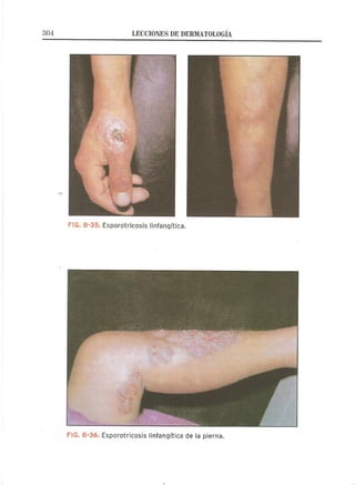 Lecciones de Dermatología