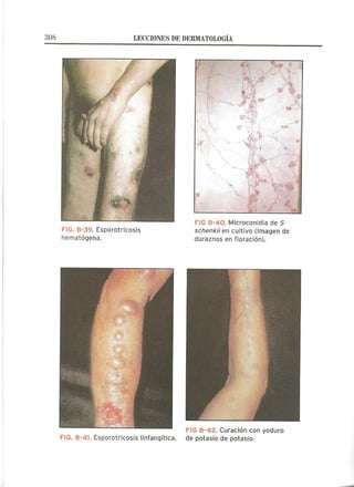 Lecciones de Dermatología