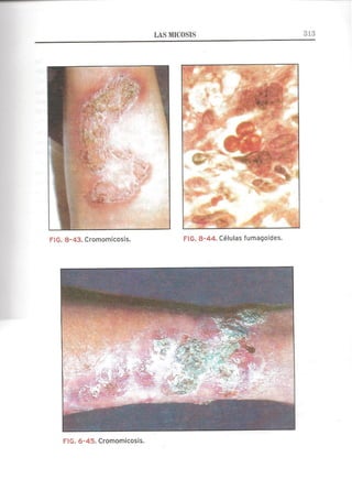 Lecciones de Dermatología