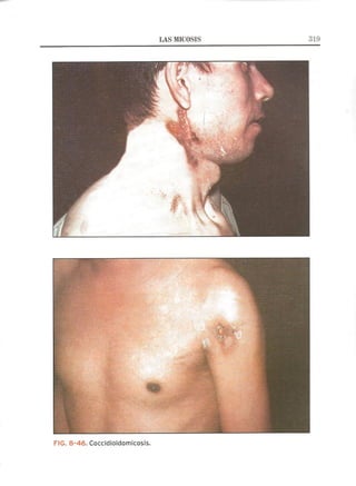 Lecciones de Dermatología