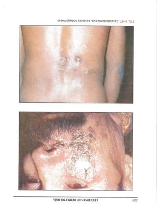 Lecciones de Dermatología