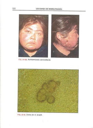 Lecciones de Dermatología