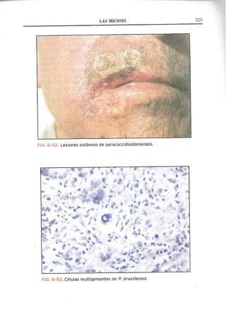 Lecciones de Dermatología