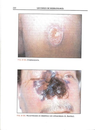 Lecciones de Dermatología