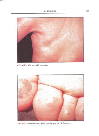 Lecciones de Dermatología