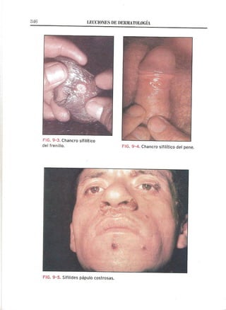 Lecciones de Dermatología