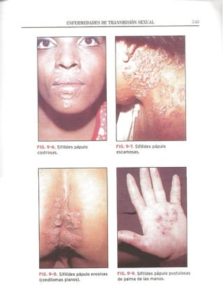 Lecciones de Dermatología