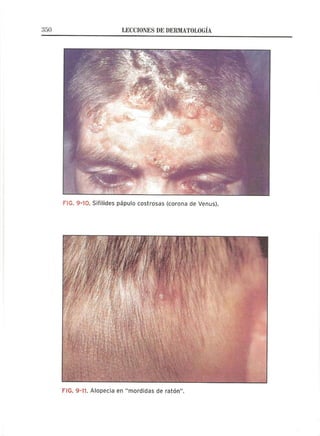 Lecciones de Dermatología