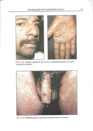 Lecciones de Dermatología