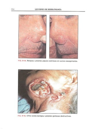 Lecciones de Dermatología