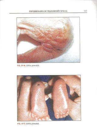 Lecciones de Dermatología