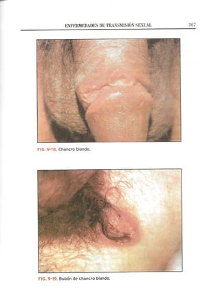 Lecciones de Dermatología