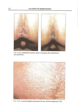 Lecciones de Dermatología