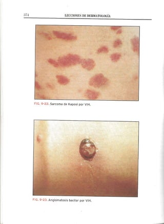 Lecciones de Dermatología