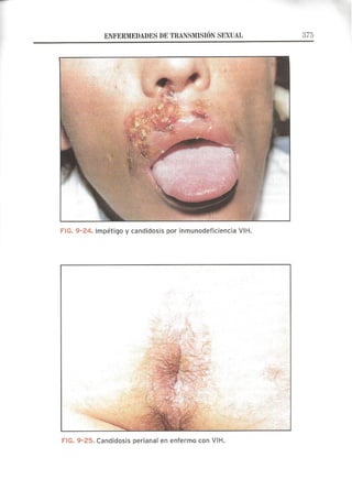 Lecciones de Dermatología