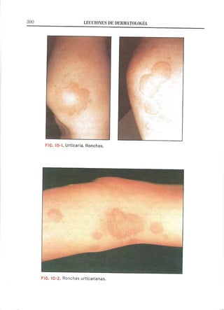 Lecciones de Dermatología