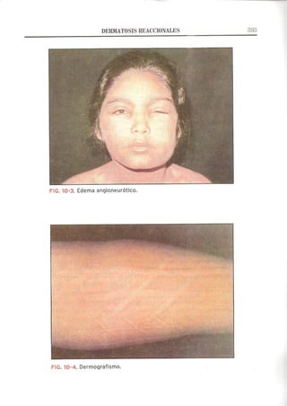 Lecciones de Dermatología