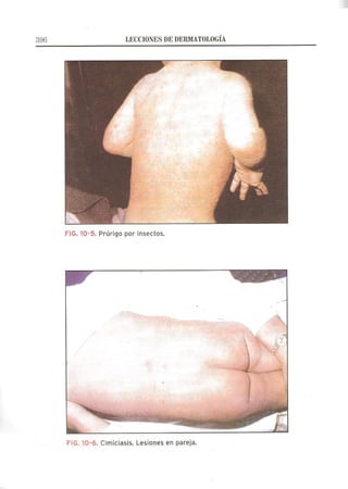 Lecciones de Dermatología