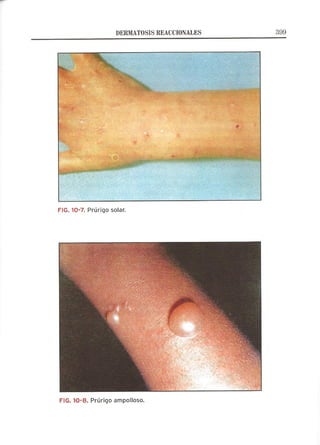 Lecciones de Dermatología