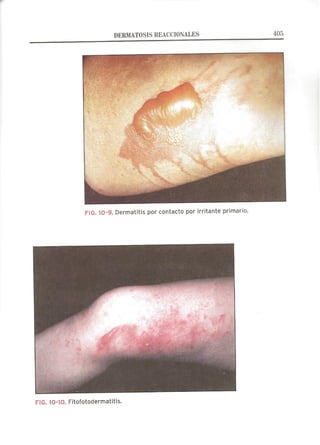 Lecciones de Dermatología