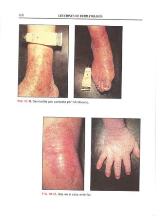 Lecciones de Dermatología