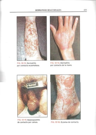 Lecciones de Dermatología