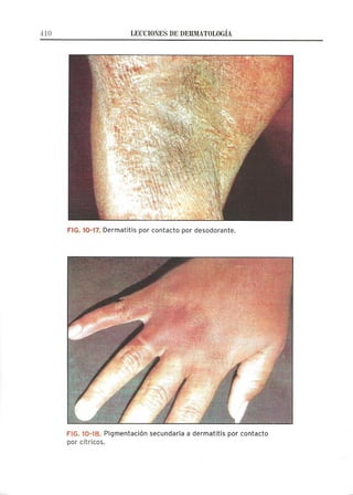 Lecciones de Dermatología