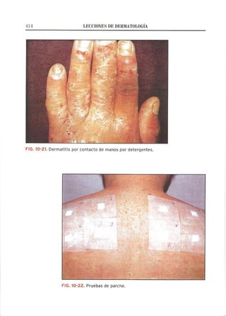 Lecciones de Dermatología