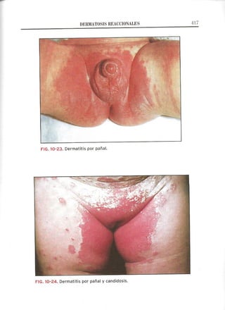 Lecciones de Dermatología