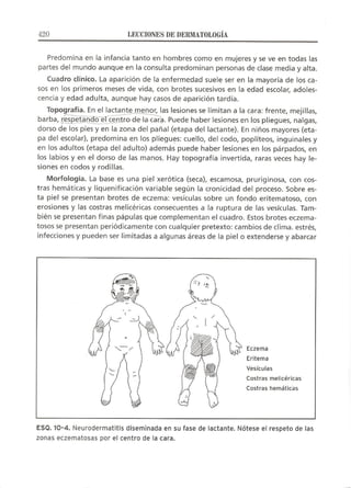 Lecciones de Dermatología
