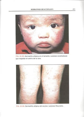 Lecciones de Dermatología