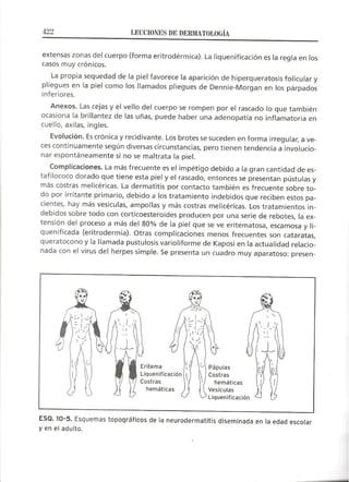 Lecciones de Dermatología