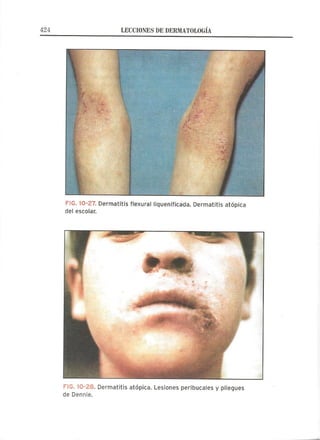 Lecciones de Dermatología