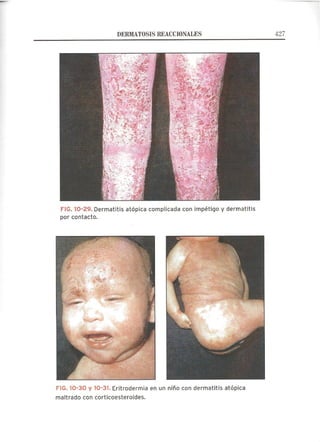 Lecciones de Dermatología