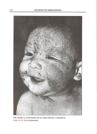 Lecciones de Dermatología