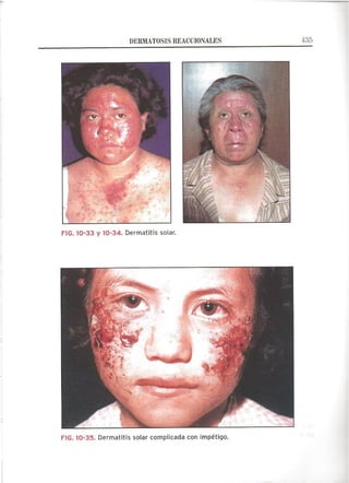 Lecciones de Dermatología