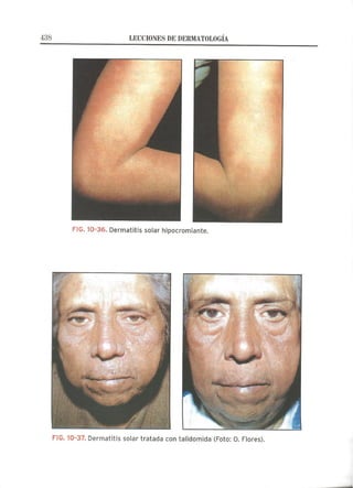 Lecciones de Dermatología