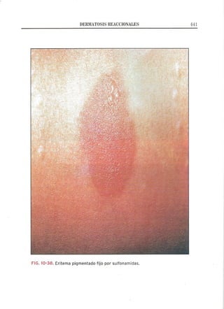 Lecciones de Dermatología