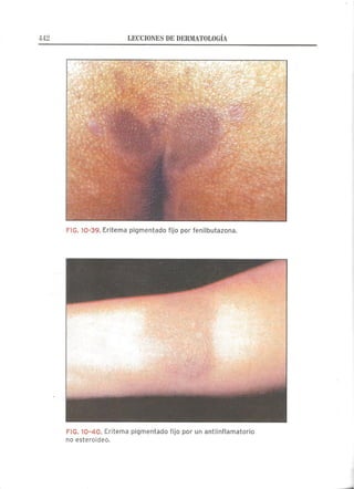 Lecciones de Dermatología