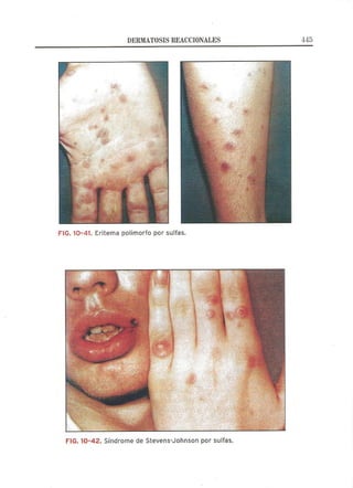 Lecciones de Dermatología