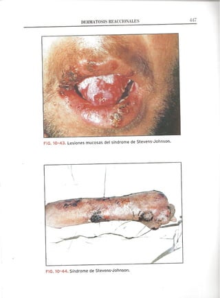 Lecciones de Dermatología