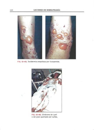 Lecciones de Dermatología