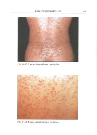 Lecciones de Dermatología