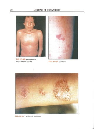 Lecciones de Dermatología